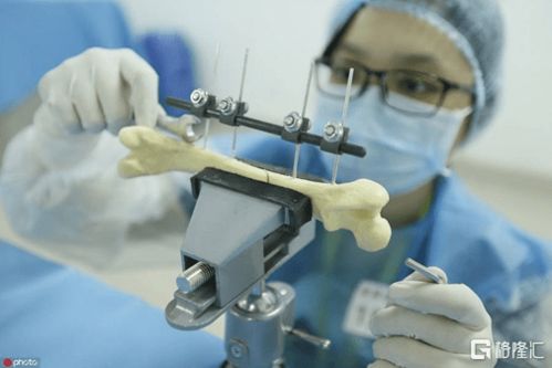 医疗器械集采靴子落地，春立医疗涨停停牌引发市场热议